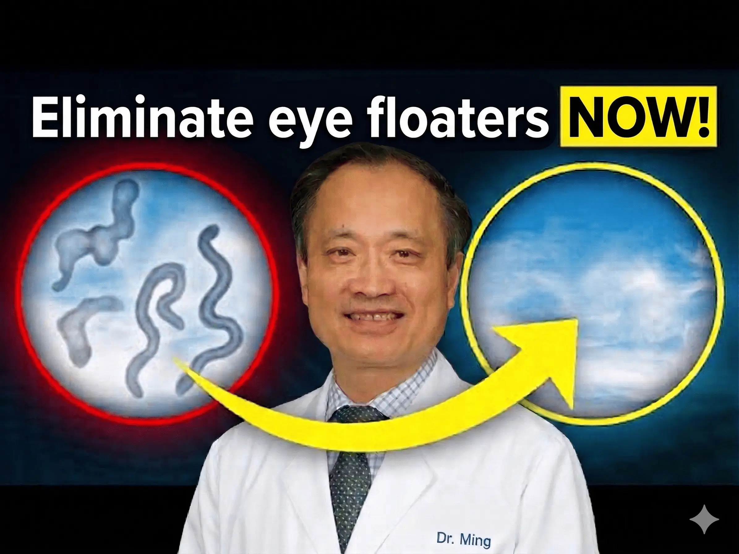 Eye floaters treatment — watch Dr. Ming's free video